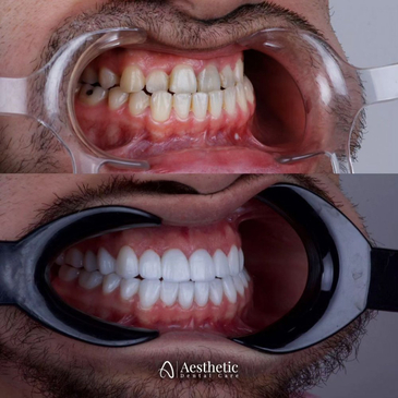 Slider image (4) Aesthetic Dental Care Costa Rica